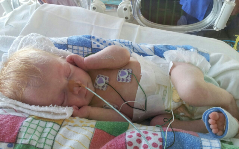 Prematurity - Our Story